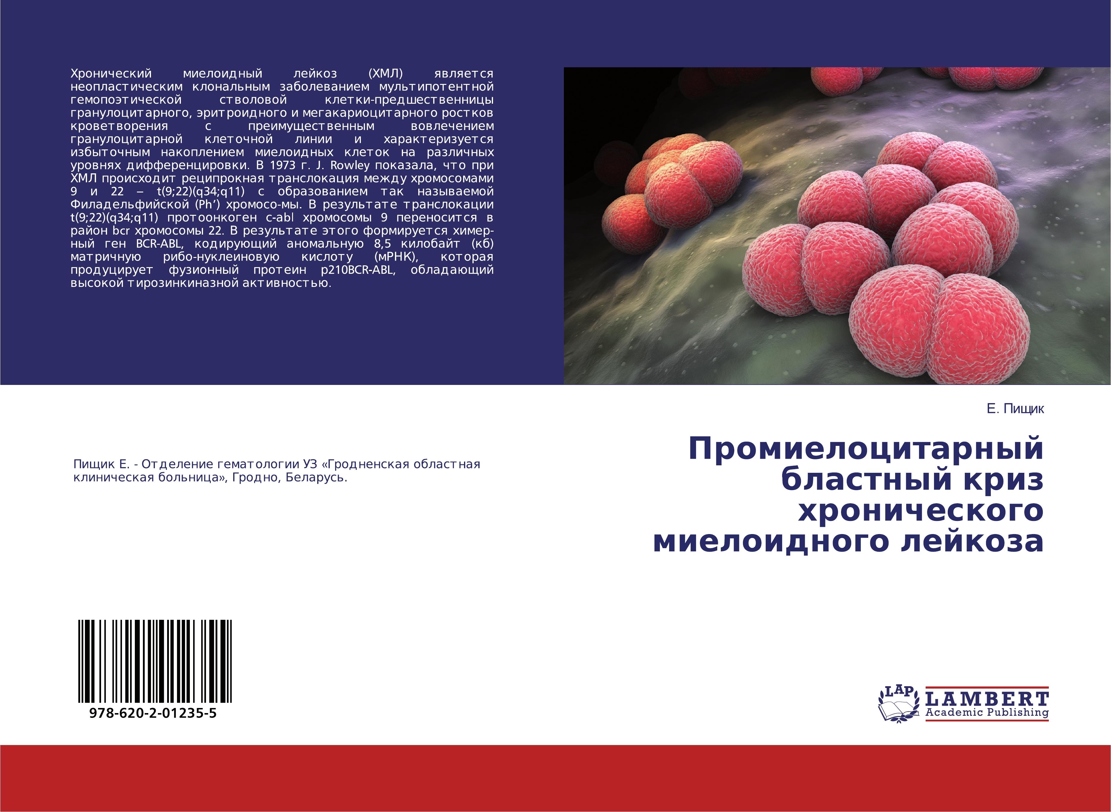 9786202012355