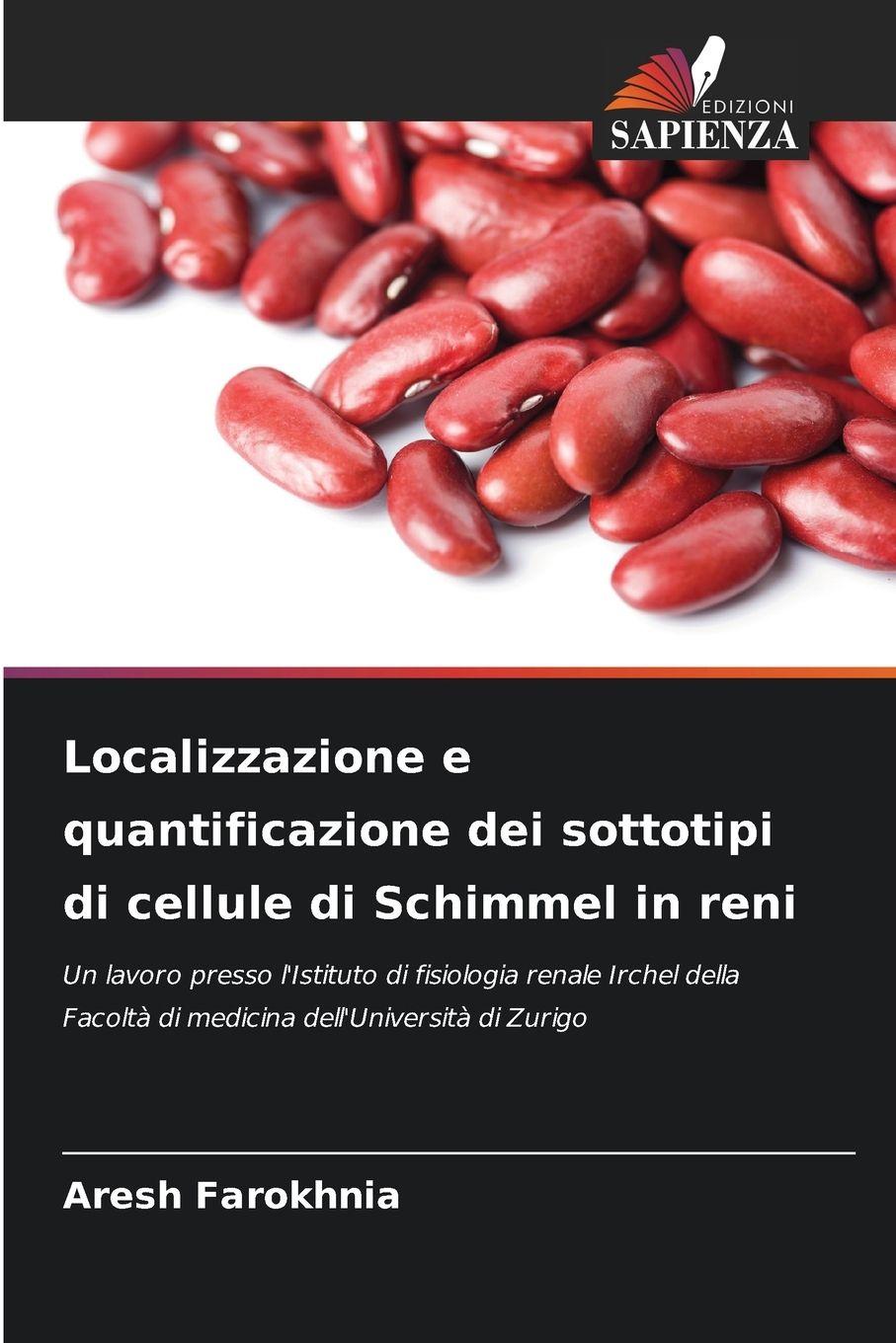 Localizzazione e quantificazione dei sottotipi di cellule di S...