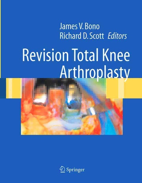 Revision Total Knee Arthroplasty (E-Book) | Buchhandlung Graff in ...