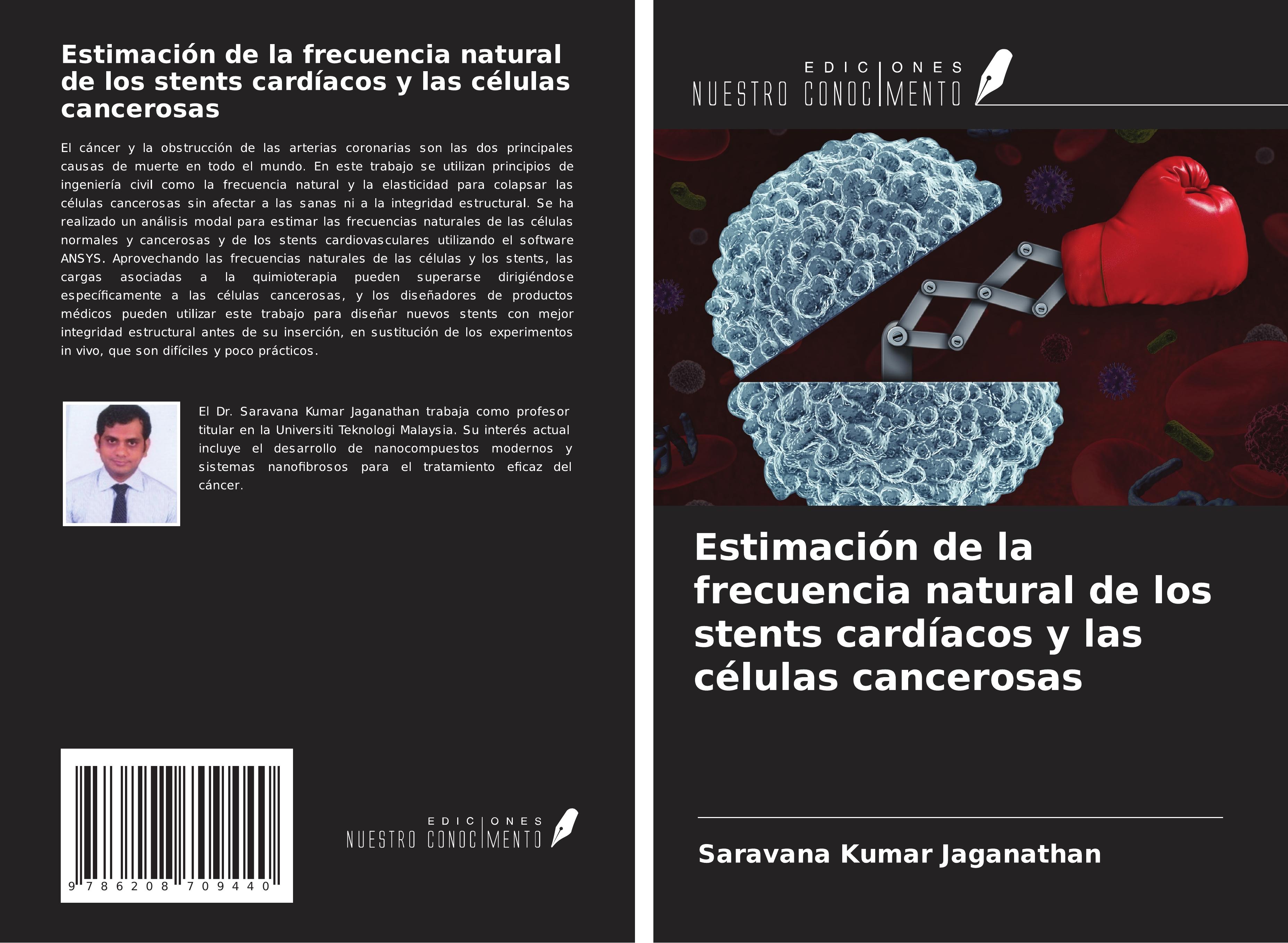 Estimación de la frecuencia natural de los stents cardíacos ...